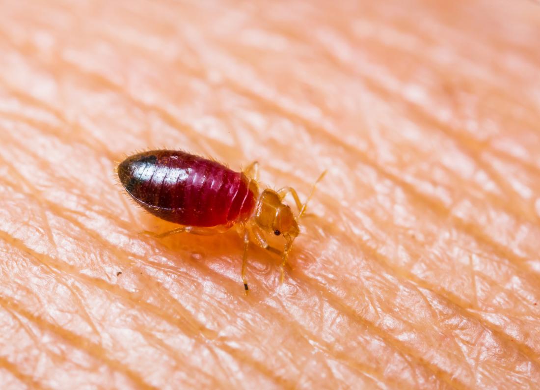 Experienced Milwaukee Bed Bug Exterminators You Can Trust
