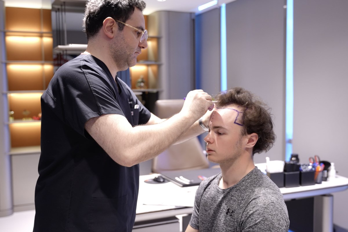 Hair transplant Turkey: Excellence with Smile Hair Clinic